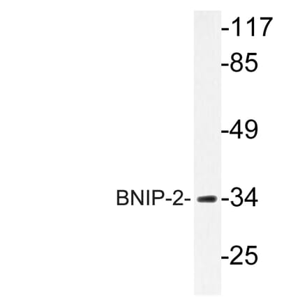 Western Blot - Anti-BNIP-2 Antibody (R12-2041) - Antibodies.com