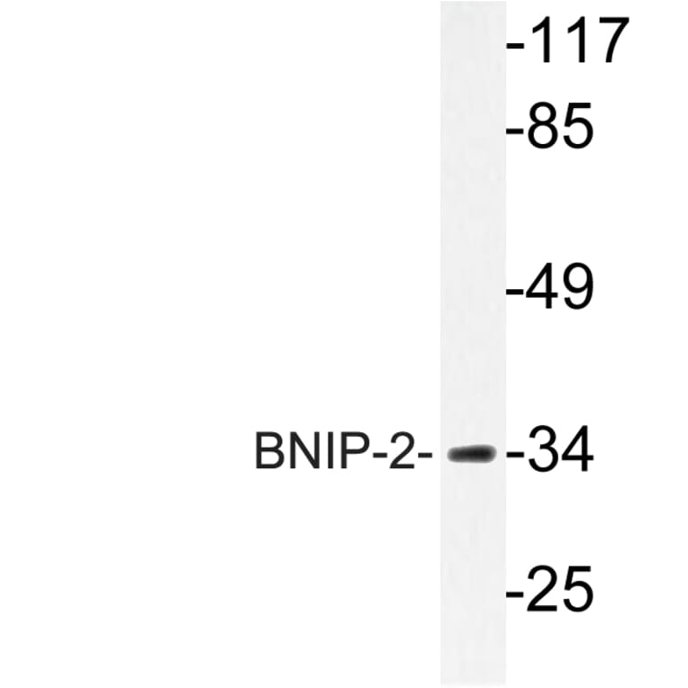 Western Blot - Anti-BNIP-2 Antibody (R12-2041) - Antibodies.com