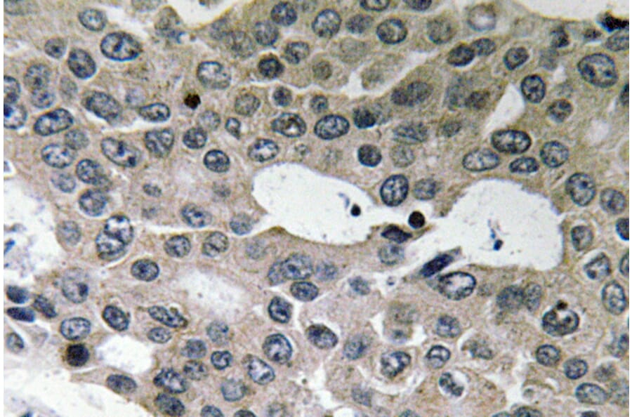 Immunohistochemistry - Anti-BNIP-2 Antibody (R12-2041) - Antibodies.com