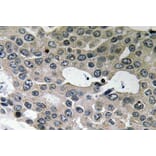 Immunohistochemistry - Anti-BNIP-2 Antibody (R12-2041) - Antibodies.com