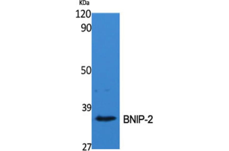 Western Blot - Anti-BNIP-2 Antibody (R12-2041) - Antibodies.com