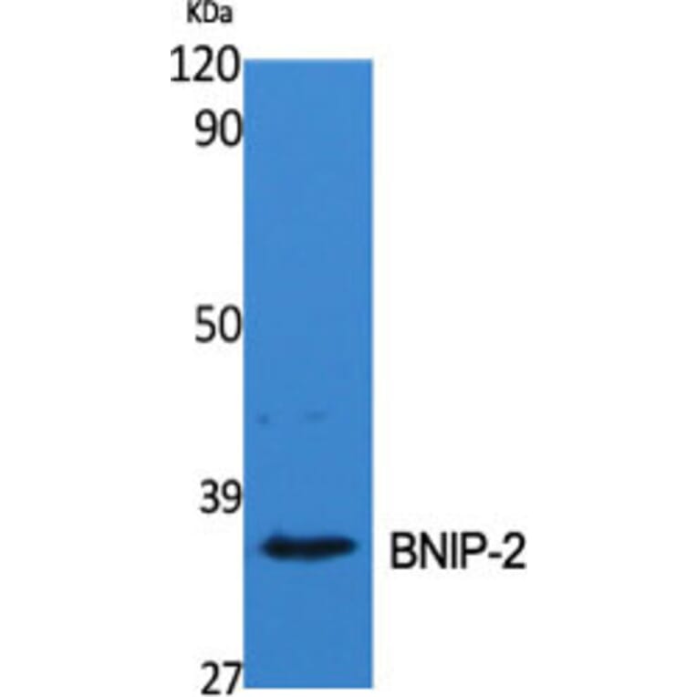 Western Blot - Anti-BNIP-2 Antibody (R12-2041) - Antibodies.com