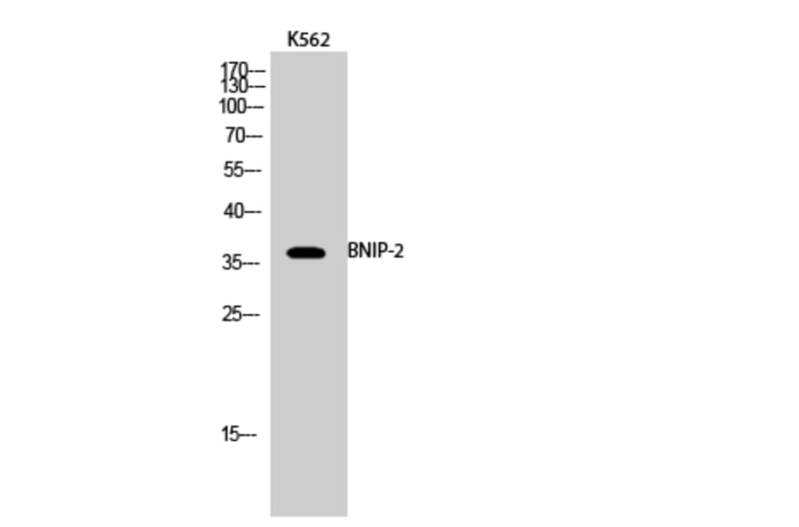 Western Blot - Anti-BNIP-2 Antibody (R12-2041) - Antibodies.com