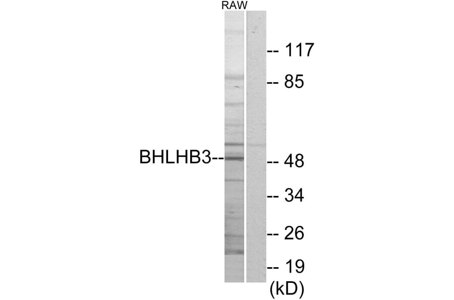 Western Blot - Anti-BHLHB3 Antibody (C11661) - Antibodies.com