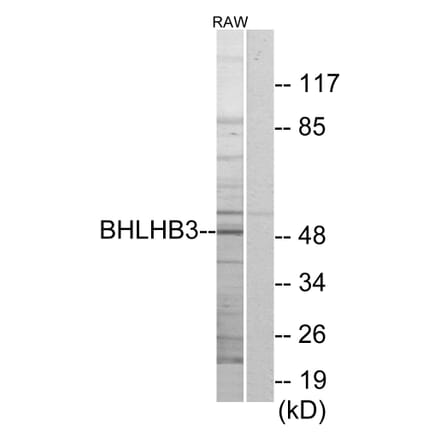 Western Blot - Anti-BHLHB3 Antibody (C11661) - Antibodies.com