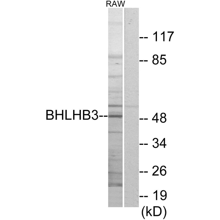 Western Blot - Anti-BHLHB3 Antibody (C11661) - Antibodies.com