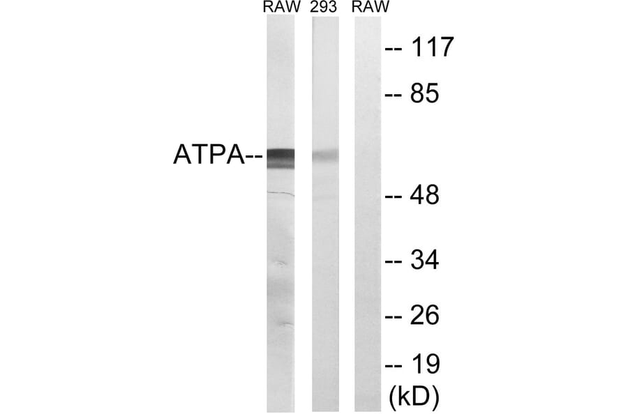 Western Blot - Anti-ATP5A1 Antibody (C14602) - Antibodies.com