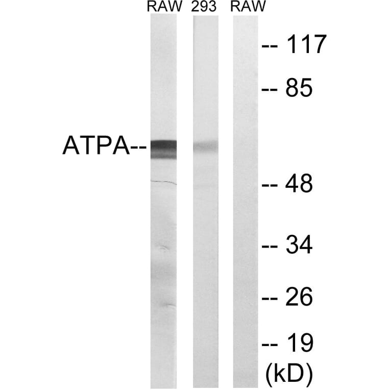 Western Blot - Anti-ATP5A1 Antibody (C14602) - Antibodies.com