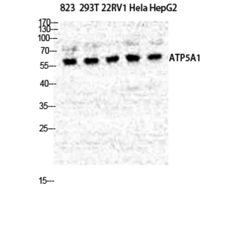 Western Blot - Anti-ATP5A1 Antibody (C14602) - Antibodies.com