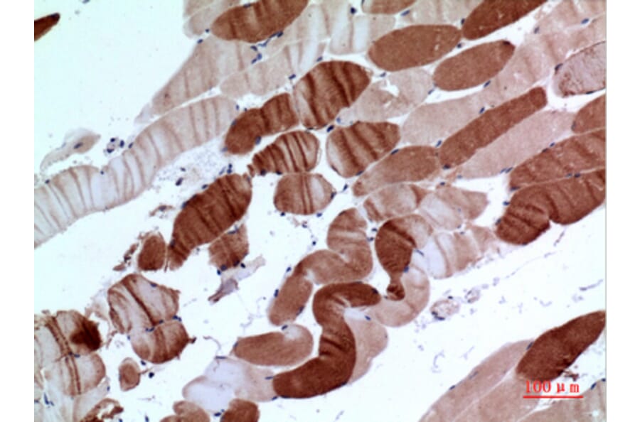 Immunohistochemistry - Anti-ATP2A2 Antibody (C30271) - Antibodies.com