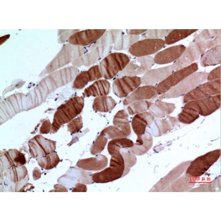 Immunohistochemistry - Anti-ATP2A2 Antibody (C30271) - Antibodies.com