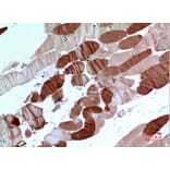 Immunohistochemistry - Anti-ATP2A2 Antibody (C30271) - Antibodies.com