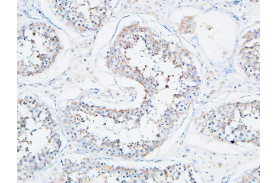 Immunohistochemistry - Anti-ATP2A2 Antibody (C30271) - Antibodies.com