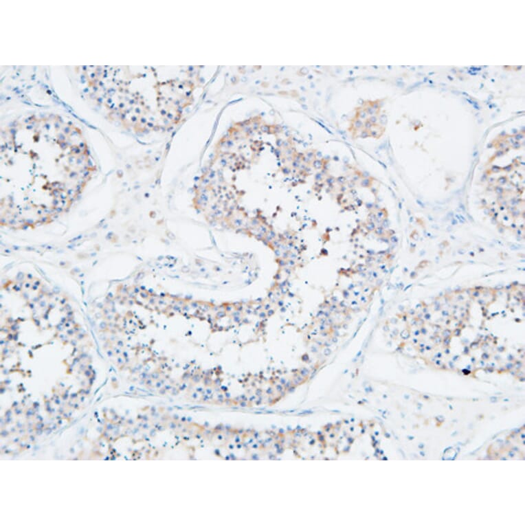 Immunohistochemistry - Anti-ATP2A2 Antibody (C30271) - Antibodies.com