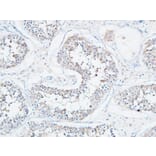 Immunohistochemistry - Anti-ATP2A2 Antibody (C30271) - Antibodies.com