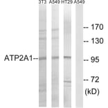 Western Blot - Anti-ATP2A1 Antibody (C18472) - Antibodies.com