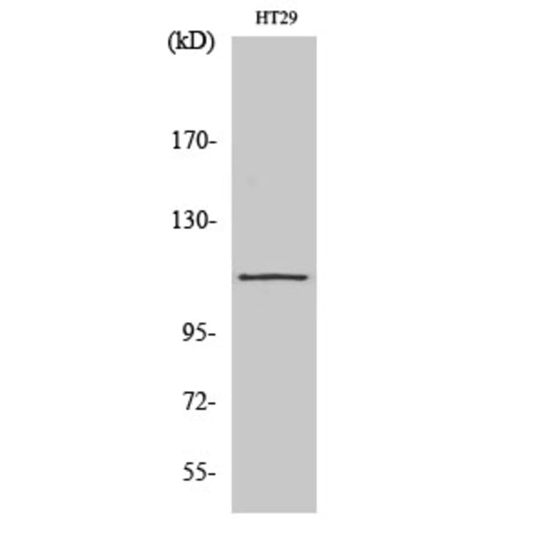Western Blot - Anti-ATP2A1 Antibody (C18472) - Antibodies.com