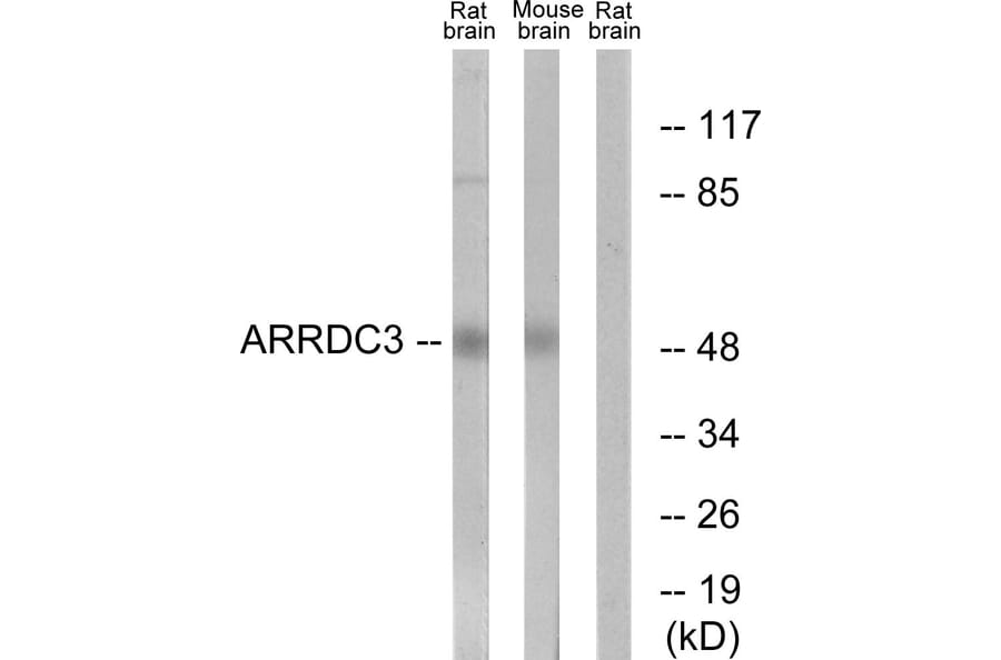 Western Blot - Anti-ARRDC3 Antibody (C12061) - Antibodies.com