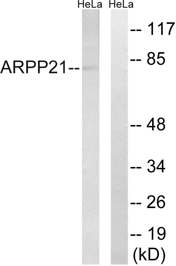 Western blot analysis of lysates from HeLa cells using Anti-ARPP21 Antibody. The right hand lane represents a negative control, where the antibody is blocked by the immunising peptide.