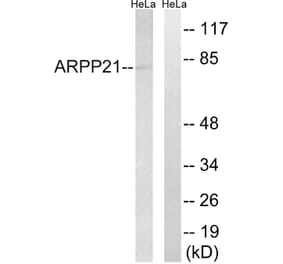 Western Blot - Anti-ARPP21 Antibody (C14899) - Antibodies.com