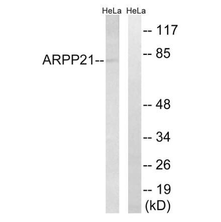Western Blot - Anti-ARPP21 Antibody (C14899) - Antibodies.com