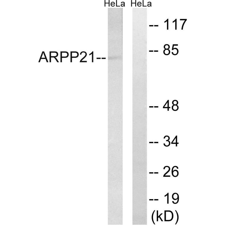 Western Blot - Anti-ARPP21 Antibody (C14899) - Antibodies.com