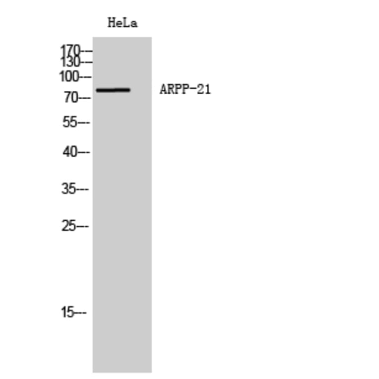 Western Blot - Anti-ARPP21 Antibody (C14899) - Antibodies.com