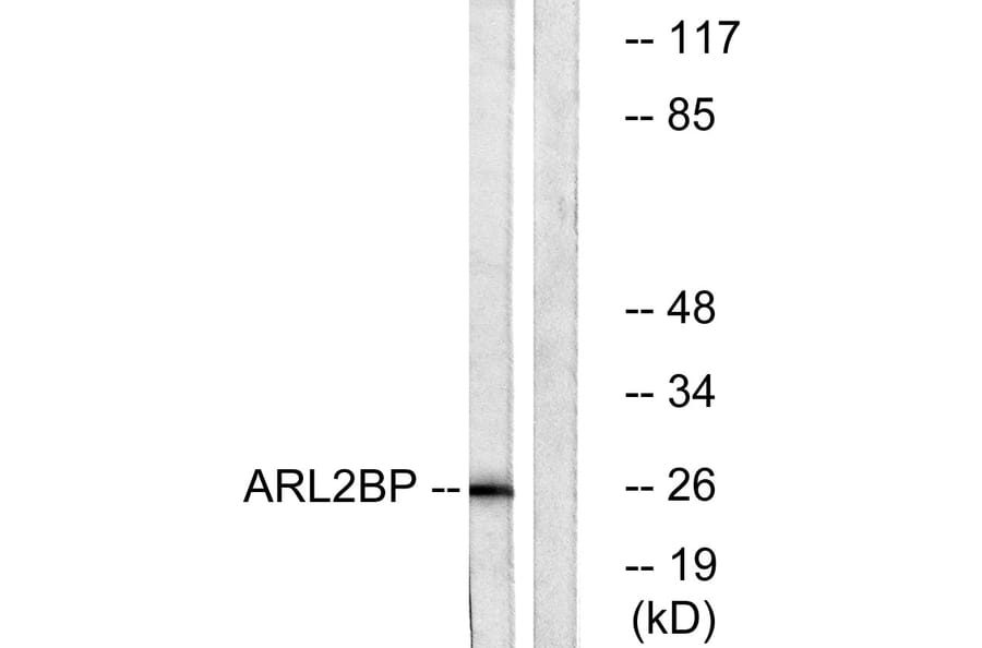 Western Blot - Anti-ARL2BP Antibody (C14350) - Antibodies.com