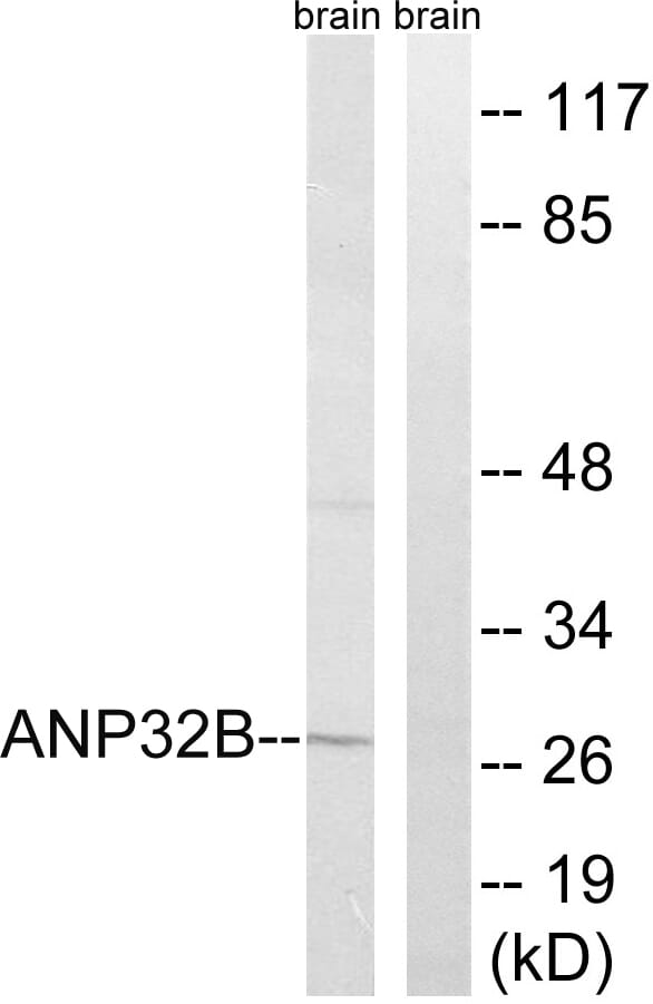 Western blot analysis of lysates from rat brain cells using Anti-ANP32B Antibody. The right hand lane represents a negative control, where the antibody is blocked by the immunising peptide.
