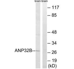 Western Blot - Anti-ANP32B Antibody (C14238) - Antibodies.com