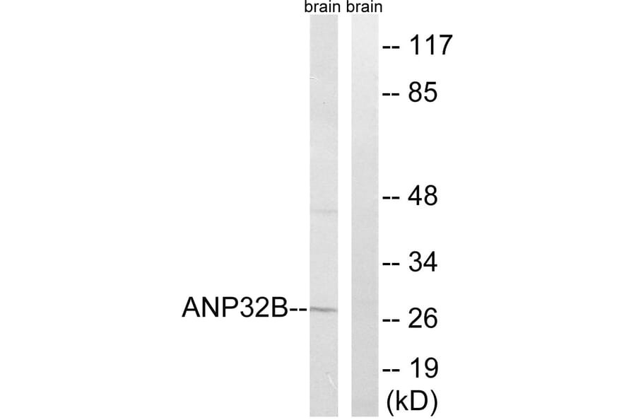 Western Blot - Anti-ANP32B Antibody (C14238) - Antibodies.com