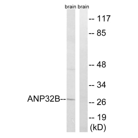 Western Blot - Anti-ANP32B Antibody (C14238) - Antibodies.com