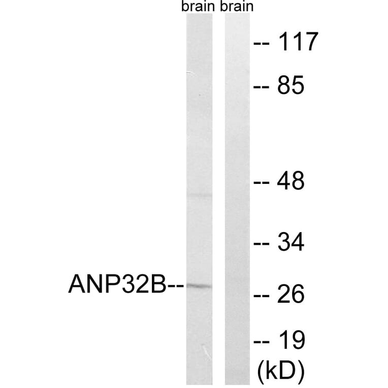 Western Blot - Anti-ANP32B Antibody (C14238) - Antibodies.com