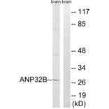 Western Blot - Anti-ANP32B Antibody (C14238) - Antibodies.com