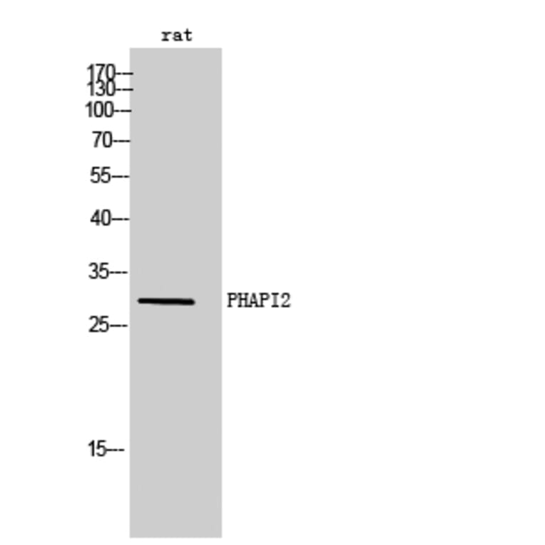 Western Blot - Anti-ANP32B Antibody (C14238) - Antibodies.com