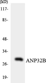 Western blot analysis of the lysates from HeLa cells using Anti-ANP32B Antibody.