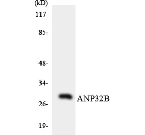 Western Blot - Anti-ANP32B Antibody (R12-2487) - Antibodies.com