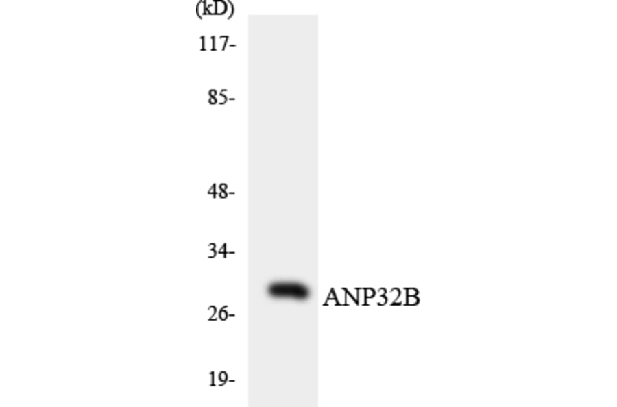 Western Blot - Anti-ANP32B Antibody (R12-2487) - Antibodies.com