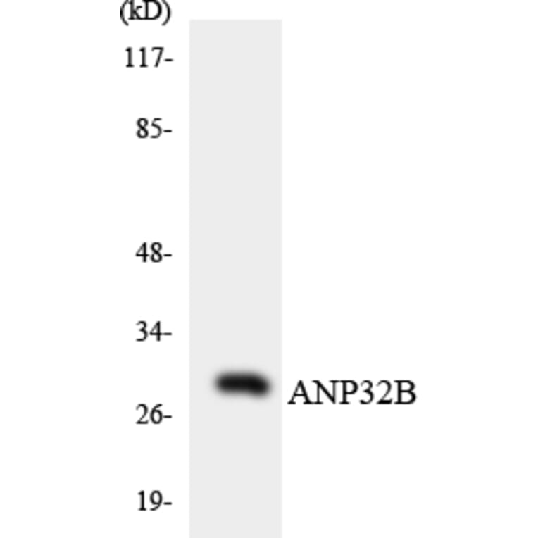 Western Blot - Anti-ANP32B Antibody (R12-2487) - Antibodies.com