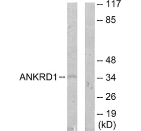 Western Blot - Anti-ANKRD1 Antibody (C11072) - Antibodies.com