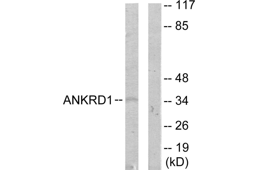 Western Blot - Anti-ANKRD1 Antibody (C11072) - Antibodies.com