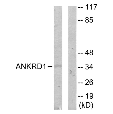 Western Blot - Anti-ANKRD1 Antibody (C11072) - Antibodies.com