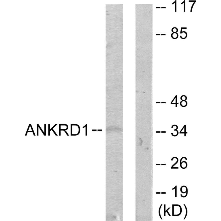 Western Blot - Anti-ANKRD1 Antibody (C11072) - Antibodies.com