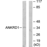 Western Blot - Anti-ANKRD1 Antibody (C11072) - Antibodies.com