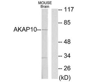 Western Blot - Anti-AKAP10 Antibody (C10110) - Antibodies.com