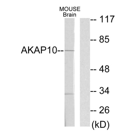 Western Blot - Anti-AKAP10 Antibody (C10110) - Antibodies.com