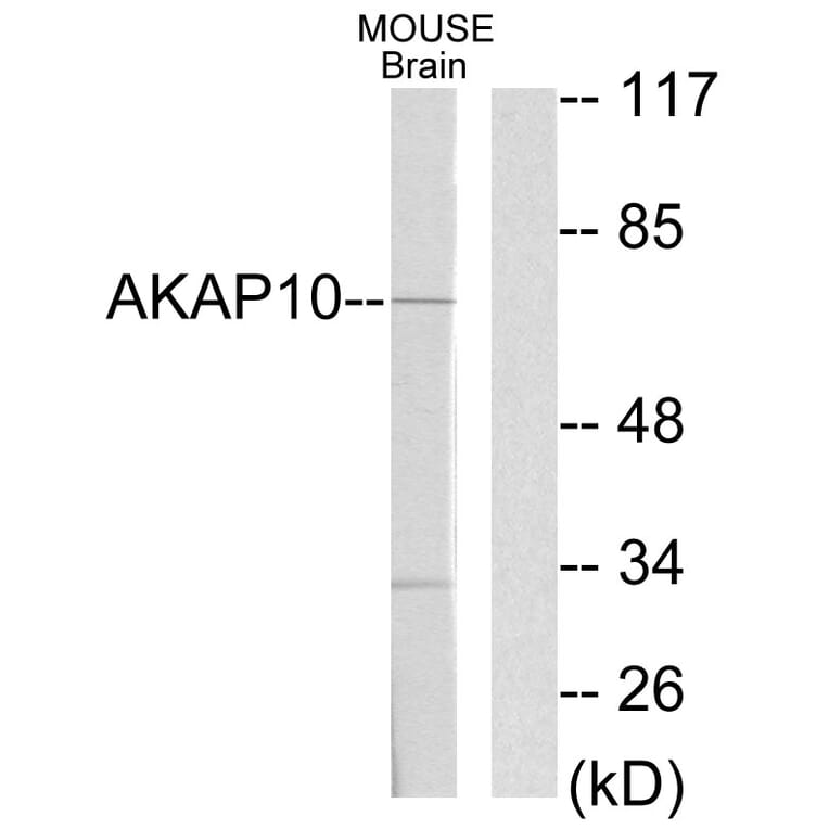 Western Blot - Anti-AKAP10 Antibody (C10110) - Antibodies.com