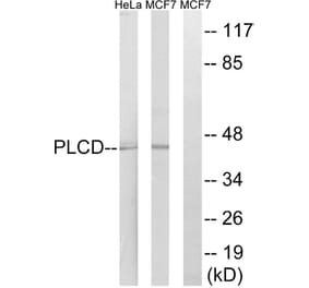 Western Blot - Anti-AGPAT4 Antibody (C14005) - Antibodies.com