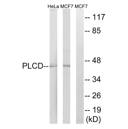 Western Blot - Anti-AGPAT4 Antibody (C14005) - Antibodies.com