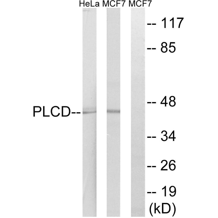 Western Blot - Anti-AGPAT4 Antibody (C14005) - Antibodies.com